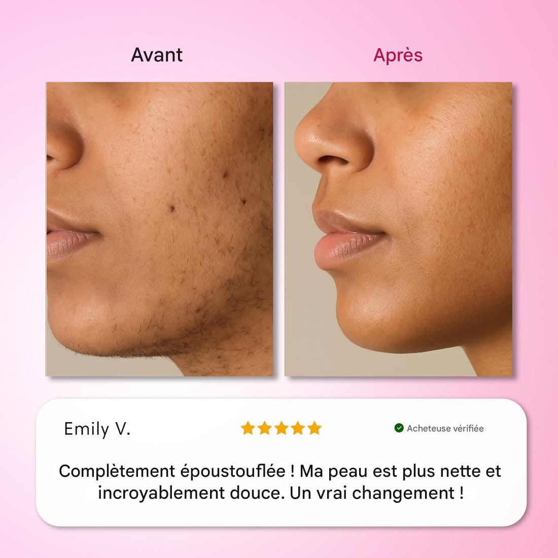 Kit d'épilation Trilogy