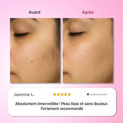 Kit d'épilation Trilogy