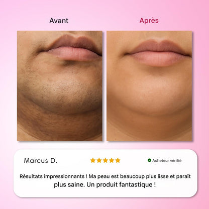 Kit d'épilation Trilogy