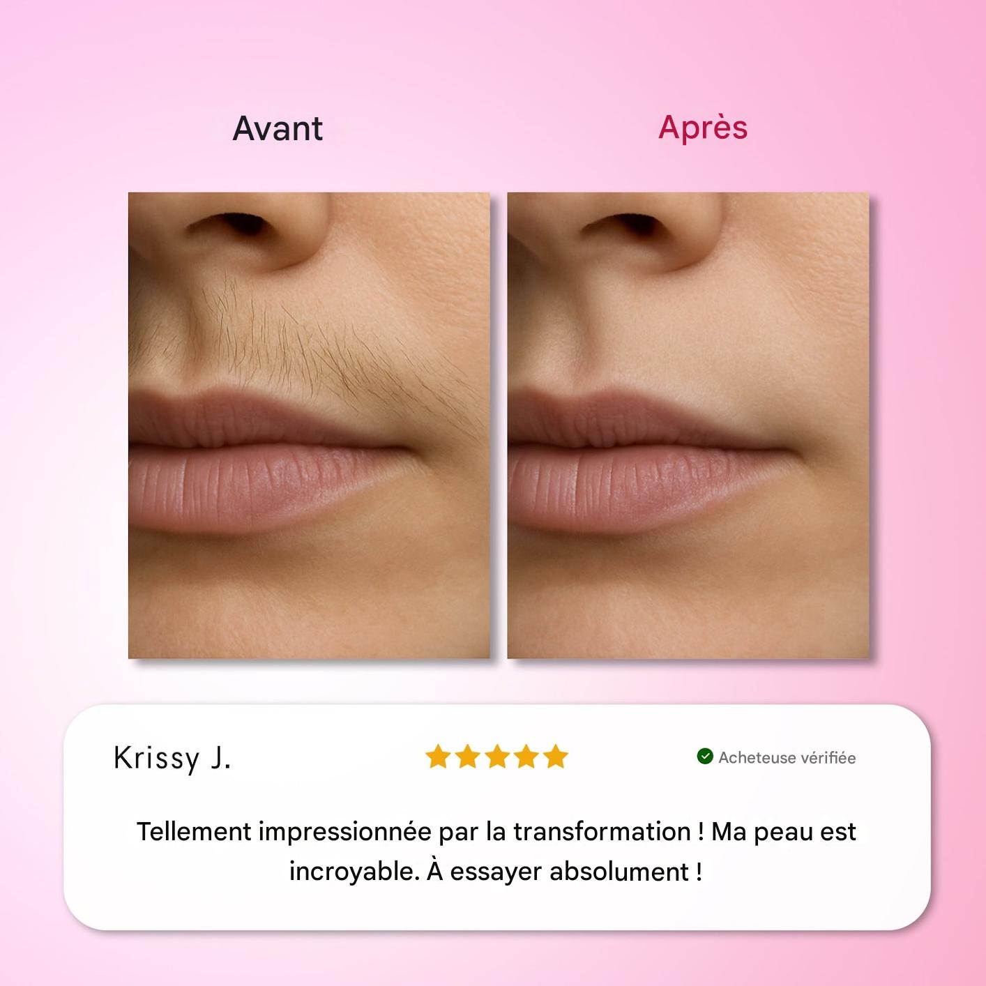 Kit d'épilation Trilogy