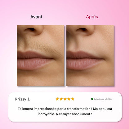 Kit d'épilation Trilogy