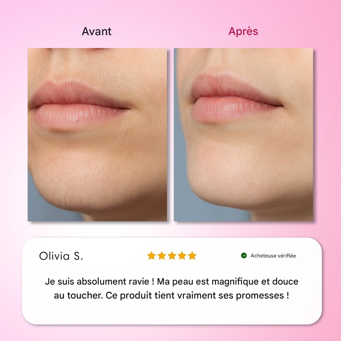 Kit d'épilation Trilogy