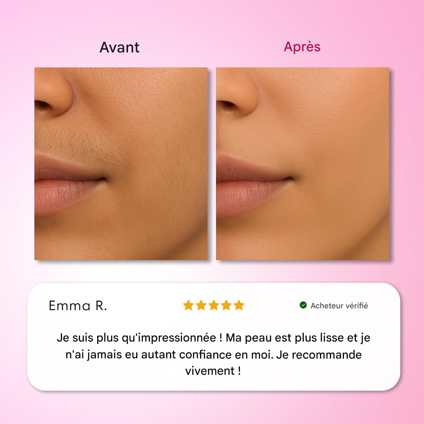 Kit d'épilation Trilogy